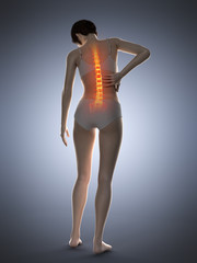 3d rendered medically accurate illustration of a woman having a painful back