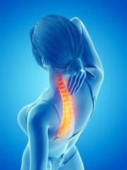 3d rendered medically accurate illustration of a woman having a painful back