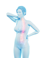 3d rendered medically accurate illustration of a woman having a painful back