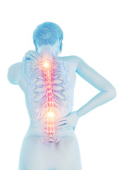 3d rendered medically accurate illustration of a woman having a painful back