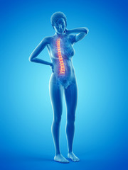 3d rendered medically accurate illustration of a woman having a backache