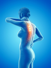 3d rendered medically accurate illustration of a woman having a backache