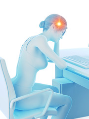 3d rendered medically accurate illustration of a woman having a painful headache while working
