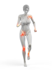 3d rendered medically accurate illustration of a woman having painful joints while walking