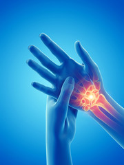 3d rendered medically accurate illustration of a woman having a painful hand