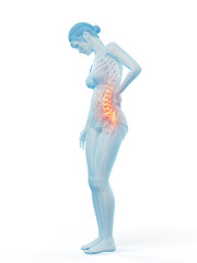 3d rendered medically accurate illustration of a woman having a painful back