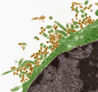 Influenza viruses, TEM