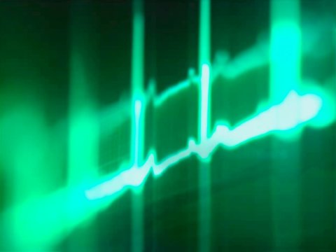 ECG, computer artwork