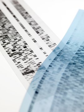 DNA autoradiograms