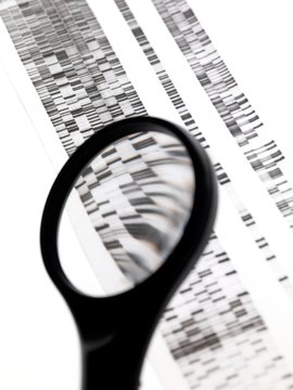 DNA autoradiogram