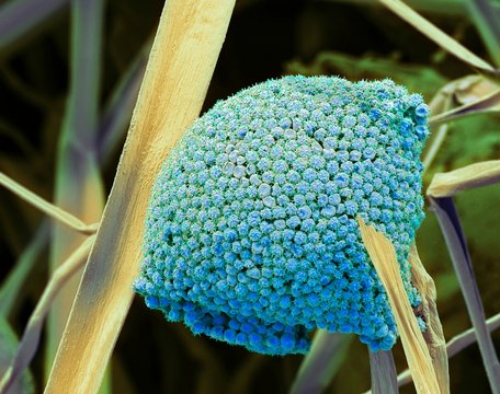 Fungal cells, SEM