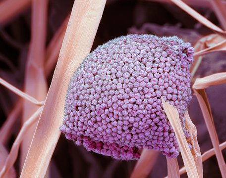 Fungal cells, SEM