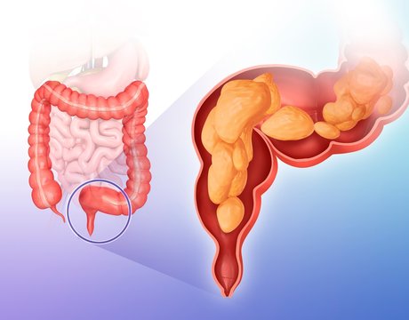 Cross section of intestine, illustration
