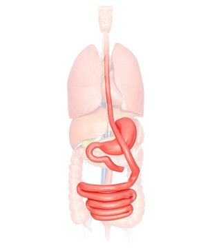 Gastric bypass, illustration