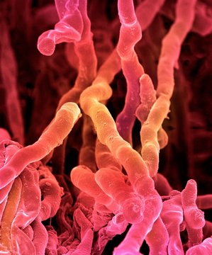 Streptomyces coelicoflavus bacteria, SEM