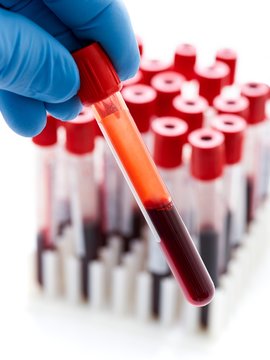 Blood sample