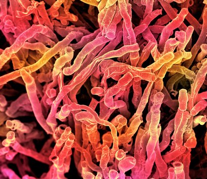 Actinomyces viscosus bacteria, SEM