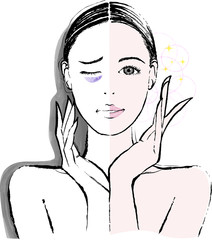 女性　クマ　ビフォーアフター