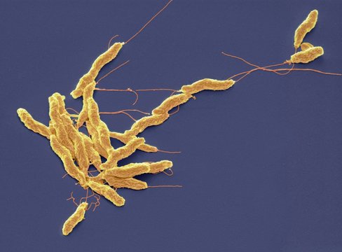 Campylobacter Jejuni Bacteria, SEM