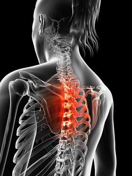 Human Thoracic Spine Pain, Illustration