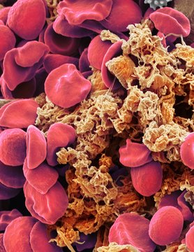 Red blood cells and platelets, SEM