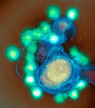 Zika virus particles, TEM