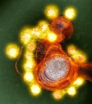 Zika virus particles, TEM