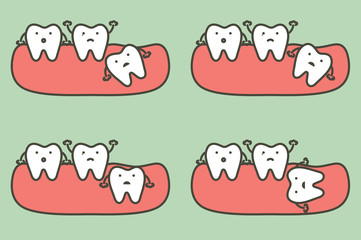 type of wisdom tooth affect to other teeth - dental cartoon vector flat style