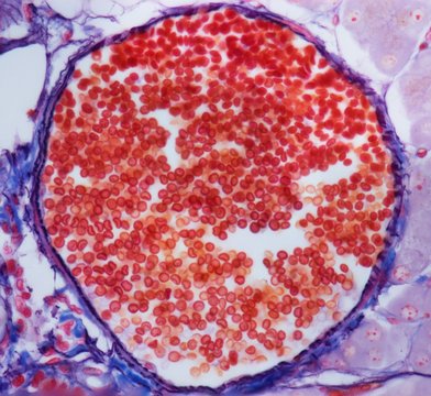 Venule, LM