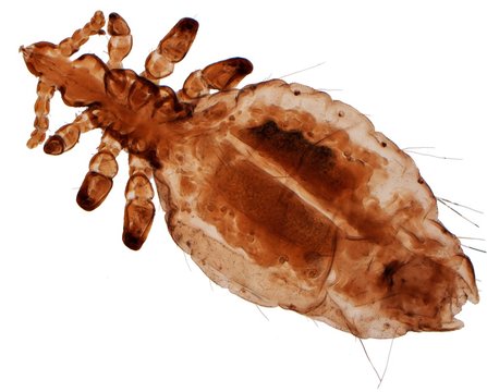 Human head louse, LM