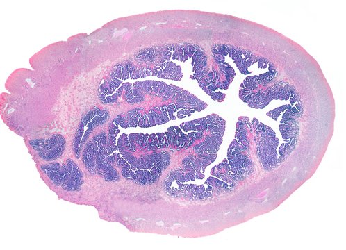 Fallopian tube, LM