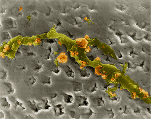 Human tooth with plaque, SEM