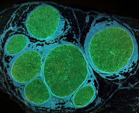 Nerve fibres, LM