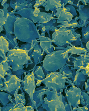 Activated platelets, SEM