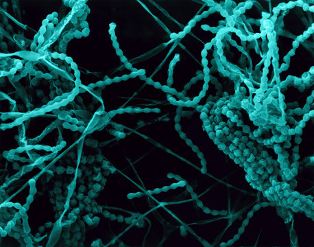 Mould, hyphae and sporangia (Penicillium sp.), SEM