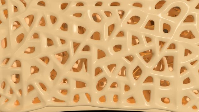 Osteoporosis Of The Vertebrae