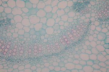 Cross-section leaf Plant of under the microscope for classroom education.