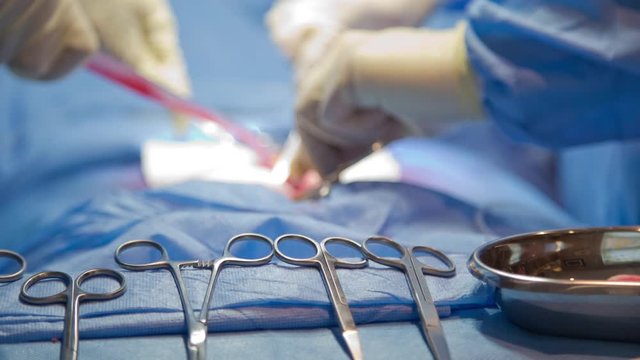 Surgeons Carry Out Complex Procedure Using Scalpels, Forceps, Sutures And Other Surgical Instruments During Surgery In Operating Theatre.