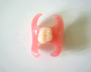 Removable denture type Butterfly on a light background. Replacement of one missing tooth. Closeup.