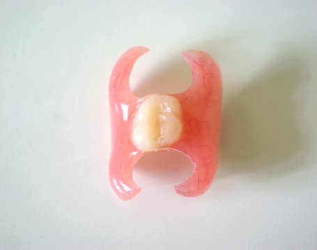 Removable denture type Butterfly on a light background. Replacement of one missing tooth. Closeup.