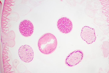 Ascaris lumbricoides