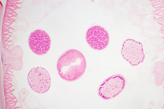 Oxyuriasis Bilder Durchsuchen 1,154 Archivfotos, und