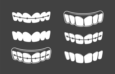 Set of teeth isolated on a black background