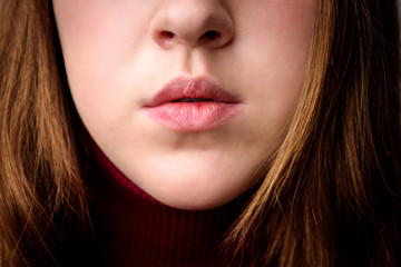 Chapped, or cracked, dry lips that have lost moisture. Woman maintains her lips. Lip Care.