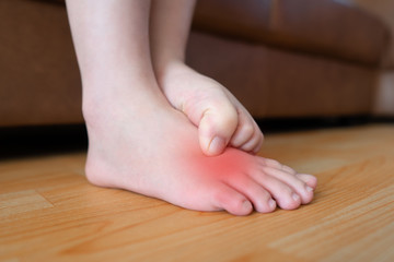 Young woman scratching the itch on her feet w/ redness rash. Cause of itchy skin include athlete's...