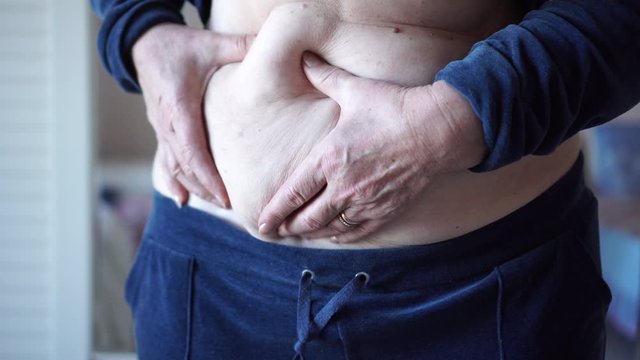 Woman holding cellulite on her fat belly. Close up of caucasian female hands testing the skin for fat and stretch marks. Body control, diet and weight loss. Fat belly, overeating problem, obesity