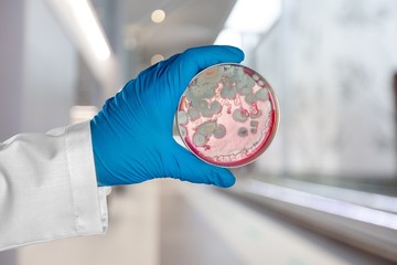 Microbiology laboratory test in scientist hand on background