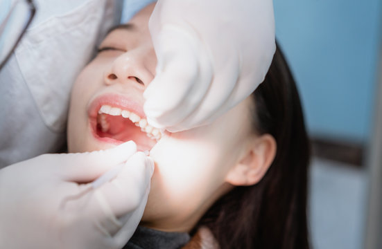 Dentist extracting teeth for young Asian woman