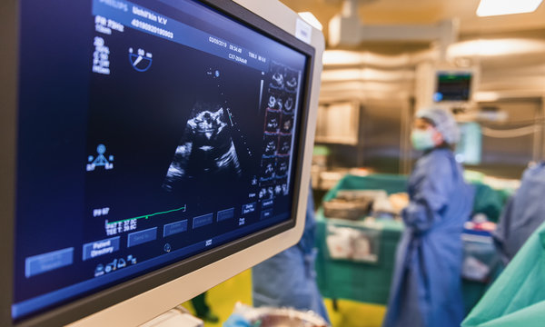 Ultrasound monitoring of the heart during surgery in operating room