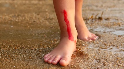 The child cut himself on coral in the sea, blood on his leg.